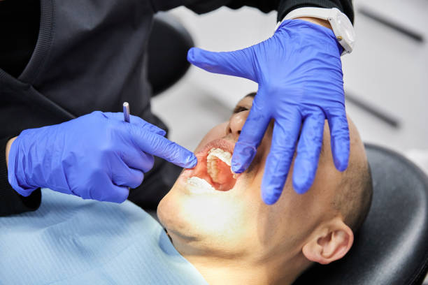 Best Emergency Dental Care for Broken or Chipped Teeth in Manche Village, CA